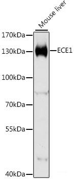 Immunofluorescence analysis of U2OS cells using NEIL1 Polyclonal Antibody