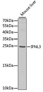 Western blot analysis of extracts of Mouse liver using JMJD6 Polyclonal Antibody at dilution of 1:1000.