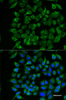 Western blot analysis of extracts of U2OS cells using TDRD3 Polyclonal Antibody at dilution of 1:1000.