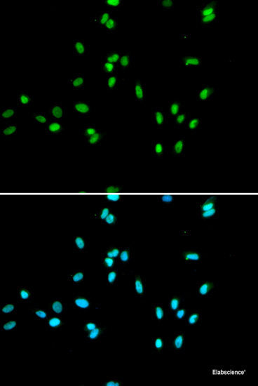 Western blot analysis of extracts of various cell lines using PRPF8 Polyclonal Antibody at dilution of 1:1000.