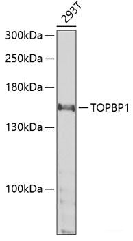 Immunohistochemistry of paraffin-embedded Human breast cancer using CIRBP Polyclonal Antibody at dilution of 1:100 (40x lens).
