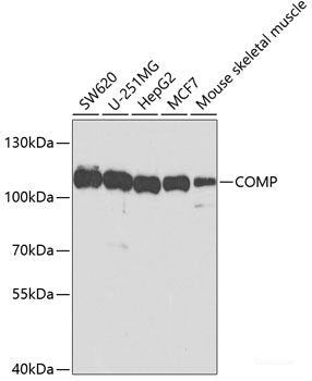 Immunofluorescence analysis of GFP-RNF168 transgenic U2OS cells using POLK Polyclonal Antibody