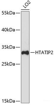 Immunohistochemistry of paraffin-embedded Mouse lung using SCNN1G Polyclonal Antibody at dilution of 1:100 (40x lens).