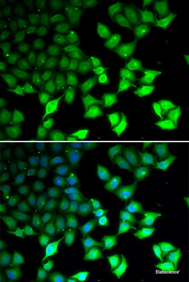 Immunofluorescence analysis of Rat brain using TRPM2 Polyclonal Antibody at dilution of 1:100. Blue: DAPI for nuclear staining.