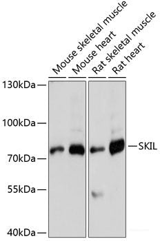 Immunohistochemistry of paraffin-embedded Human prostate using MYLIP Polyclonal Antibody at dilution of 1:100 (40x lens).