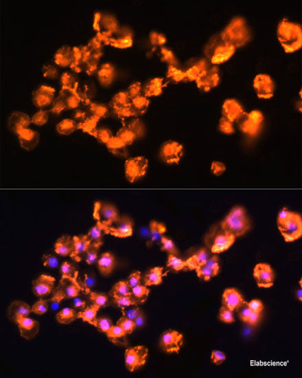 Immunohistochemistry of paraffin-embedded Rat spleen using CSF3 Polyclonal Antibody at dilution of 1:100 (40x lens).
