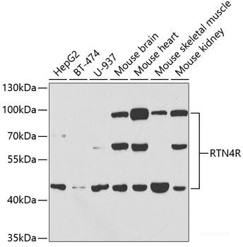 Immunofluorescence analysis of U2OS cells using UGT1A1 Polyclonal Antibody