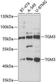 Immunohistochemistry of paraffin-embedded Human prostate using CXCL11 Polyclonal Antibody at dilution of 1:100 (40x lens).