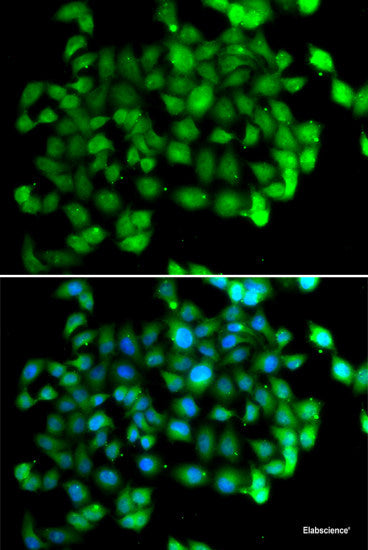 Immunofluorescence analysis of HeLa cells using ATXN1 Polyclonal Antibody
