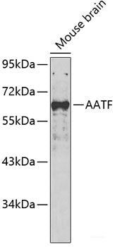 Western blot analysis of extracts of various cell lines using GZMA Polyclonal Antibody at dilution of 1:1000.