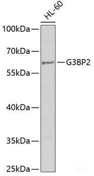 Immunohistochemistry of paraffin-embedded Rat heart using PLEK Polyclonal Antibody at dilution of 1:200 (40x lens).