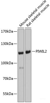 Immunohistochemistry of paraffin-embedded Rat lung using UBE2B Polyclonal Antibody at dilution of 1:100 (40x lens).