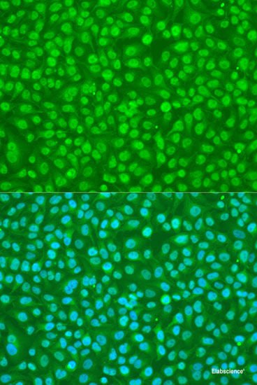 Immunohistochemistry of paraffin-embedded Rat kidney using BCAP29 Polyclonal Antibody at dilution of 1:100 (40x lens).