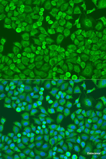 Immunohistochemistry of paraffin-embedded Rat brain using SYP Polyclonal Antibody at dilution of 1:100 (40x lens).
