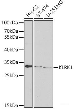 Immunofluorescence analysis of MCF7 cells using SLC26A2 Polyclonal Antibody