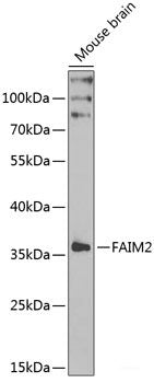Immunohistochemistry of paraffin-embedded Mouse brain using MSRA Polyclonal Antibody at dilution of 1:100 (40x lens).