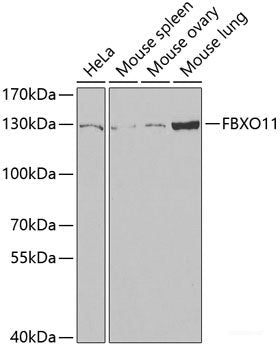 Western blot analysis of extracts of various cell lines using NDUFS4 Polyclonal Antibody at dilution of 1:1000.