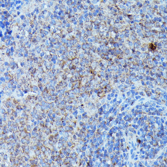 Immunohistochemistry of paraffin-embedded Rat kidney using PNLIP Polyclonal Antibody at dilution of 1:200 (40x lens).