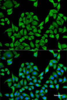 Immunohistochemistry of paraffin-embedded Rat brain using PTPN3 Polyclonal Antibody at dilution of 1:100 (40x lens).