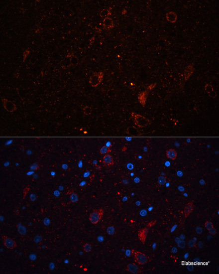 Western blot analysis of extracts of various cell lines using RCVRN Polyclonal Antibody at dilution of 1:1000.