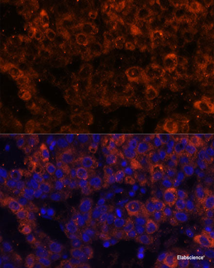 Immunohistochemistry of paraffin-embedded Mouse heart using SFRP4 Polyclonal Antibody at dilution of 1:100 (40x lens).