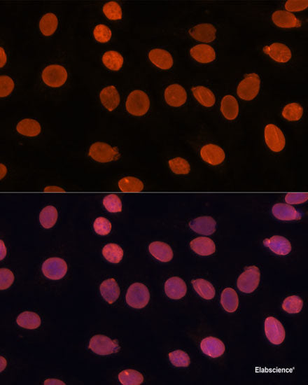 Western blot analysis of extracts of Mouse brain using TNFAIP6 Polyclonal Antibody at dilution of 1:1000.