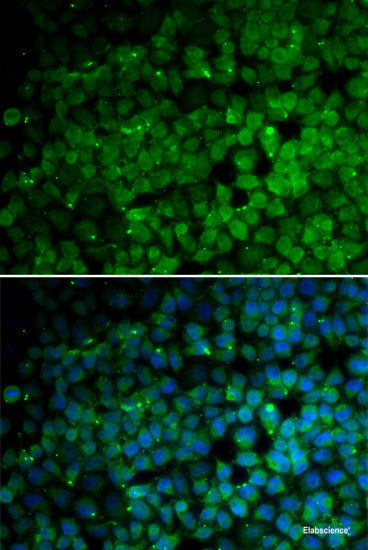Immunofluorescence analysis of U2OS cells using TPD52L1 Polyclonal Antibody