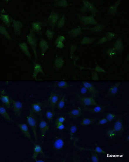 Immunofluorescence analysis of A549 cells using POMGNT2 Polyclonal Antibody
