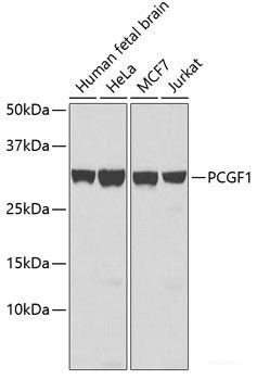 Immunofluorescence analysis of A549 cells using FLCN Polyclonal Antibody