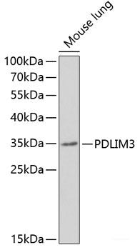 Western blot analysis of extracts of Mouse liver using PRDM14 Polyclonal Antibody at dilution of 1:1000.