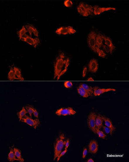 Immunofluorescence analysis of A549 cells using DNMT3A Polyclonal Antibody