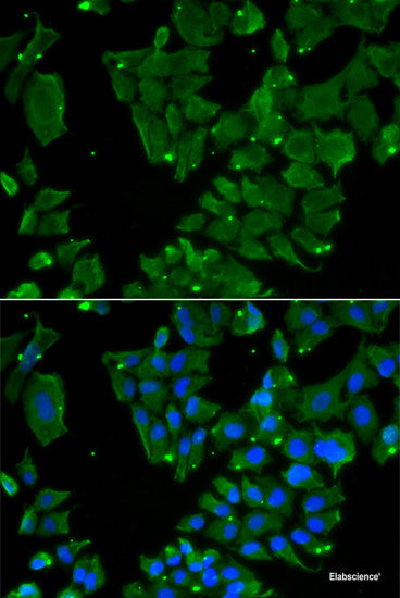Immunofluorescence analysis of MCF7 cells using ANTXR1 Polyclonal Antibody