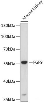 Western blot analysis of extracts of various cell lines using ATOH1 Polyclonal Antibody at dilution of 1:1000.