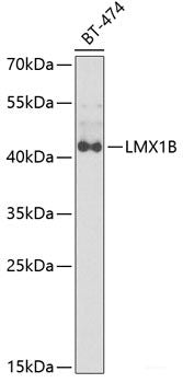 Immunohistochemistry of paraffin-embedded Mouse heart using CARS Polyclonal Antibody at dilution of 1:100 (40x lens).