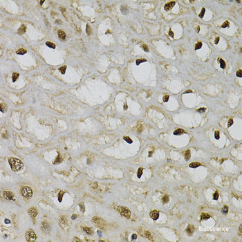 Immunohistochemistry of paraffin-embedded Human prostate using COCH Polyclonal Antibody at dilution of 1:100 (40x lens).