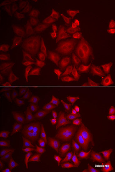 Immunofluorescence analysis of HeLa cells using CPSF3L Polyclonal Antibody