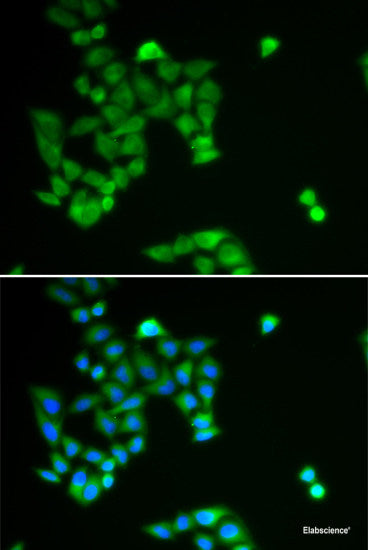 Western blot analysis of extracts of various cell lines using GM2A Polyclonal Antibody at dilution of 1:1000.