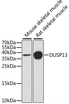 Western blot analysis of extracts of various cell lines using IL9R Polyclonal Antibody at dilution of 1:1000.