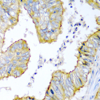 Immunofluorescence analysis of MCF7 cells using KIF3A Polyclonal Antibody