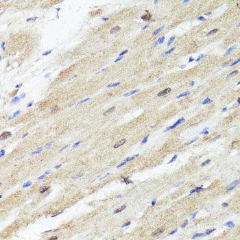 Western blot analysis of extracts of various cell lines using KLF4 Polyclonal Antibody at dilution of 1:1000.