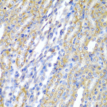 Immunofluorescence analysis of A549 cells using LECT1 Polyclonal Antibody