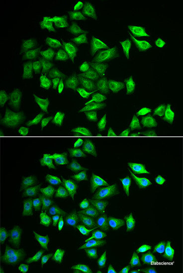 Western blot analysis of extracts of Mouse stomach using MLPH Polyclonal Antibody at dilution of 1:1000.