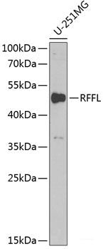 Western blot analysis of extracts of various cell lines using MXI1 Polyclonal Antibody at dilution of 1:1000.