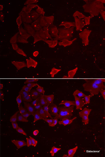 Immunofluorescence analysis of U2OS cells using MYLK3 Polyclonal Antibody