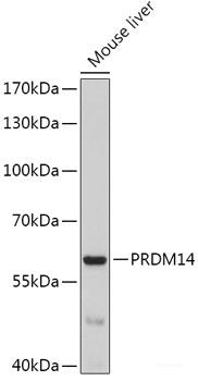 Immunofluorescence analysis of HeLa cells using NFATC3 Polyclonal Antibody
