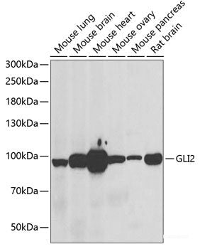 Western blot analysis of extracts of various cell lines using NPHP1 Polyclonal Antibody at dilution of 1:1000.