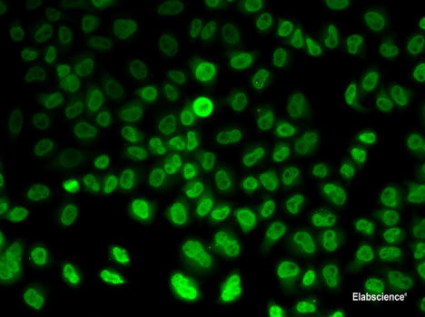 Immunohistochemistry of paraffin-embedded Human liver damage using PIK3CG Polyclonal Antibody