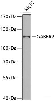 Immunohistochemistry of paraffin-embedded Human liver damage using SRI Polyclonal Antibody at dilution of 1:100 (40x lens).