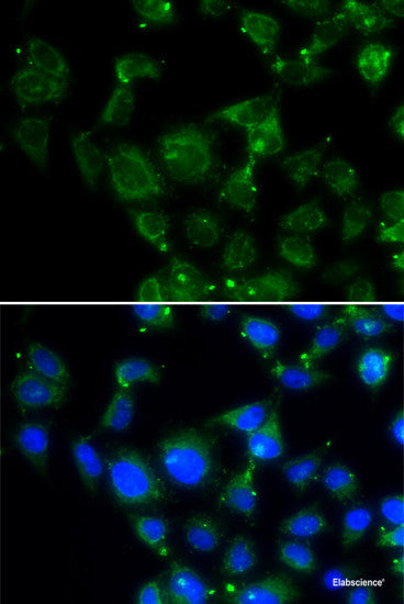 Western blot analysis of extracts of THP-1 cells using DCLRE1B Polyclonal Antibody at dilution of 1:1000.