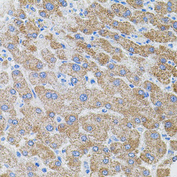 Immunohistochemistry of paraffin-embedded Mouse brain using CLCN7 Polyclonal Antibody at dilution of 1:100 (40x lens).